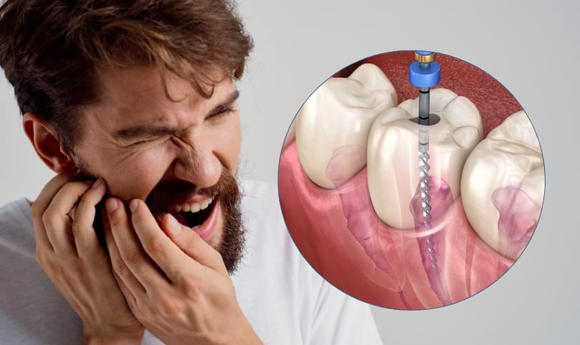 Emergency Pain Relief & Root Canal